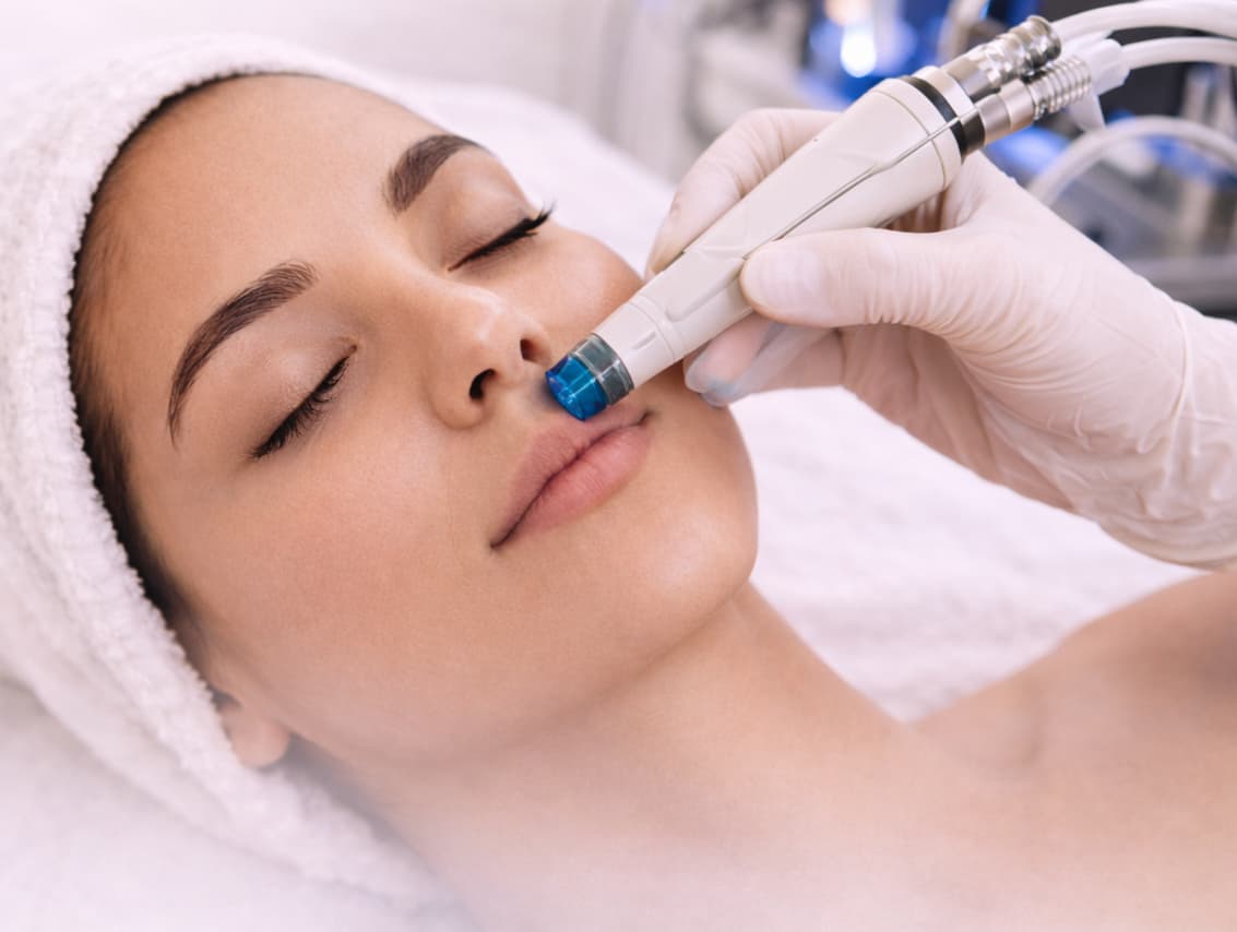 Hydra Facials