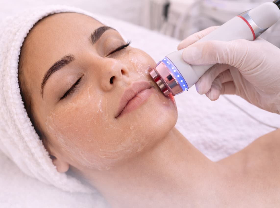 Radio Frequency Facial